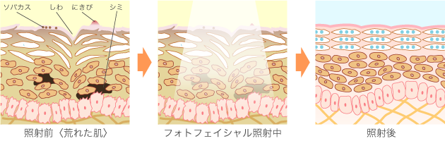 photofacial_2 photofacial_2